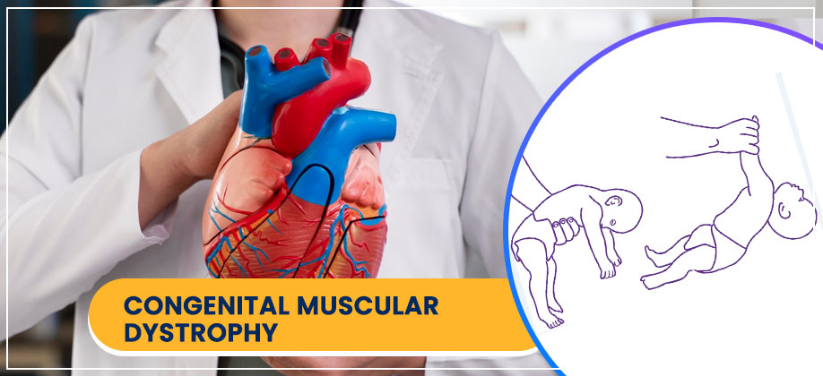 Congenital Muscular Dystrophy (CMD)